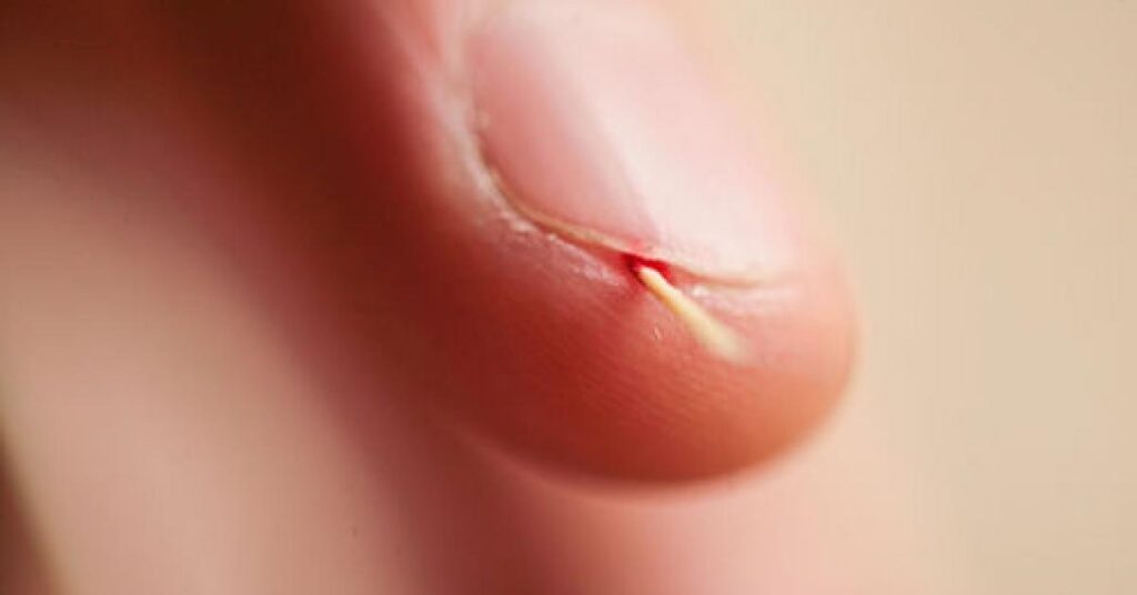 Qué significa soñar con espinas en la mano derecha